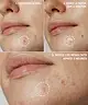 By BEAUTY BAY - Hydrocolloid Spot Patches x 2 Duo - 288pcs