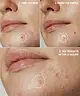 By BEAUTY BAY - Hydrocolloid Spot Patches - 144pcs
