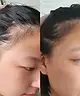 Vida Glow - Hairology™